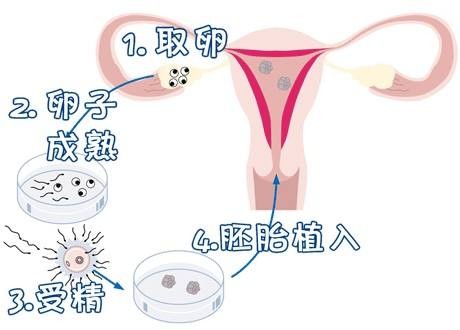 关于正规同性代孕咨询包生儿子